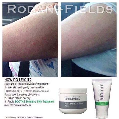 Ready To Get Rid Of Those Pesky Red Bumps On Your Arms And Legs