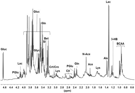 Leucine NMR Spectra