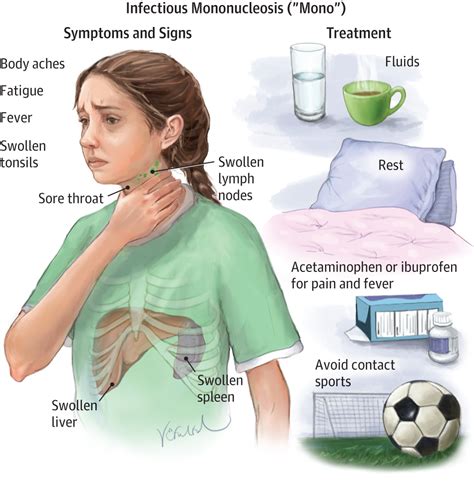 Infectious Mononucleosis Allergy And Clinical Immunology Jama The