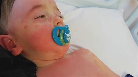 Some children have developed a rare but serious disease that is linked. New COVID-19 Symptom Can Cause Inflammation in Children ...