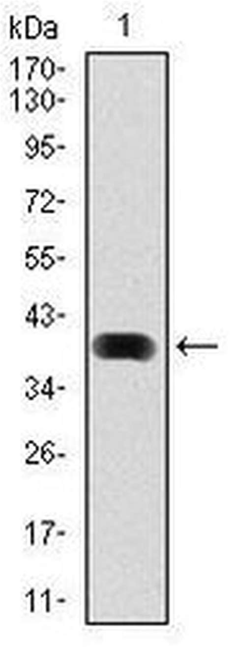 lc3b monoclonal antibody 5h12 ma5 17115