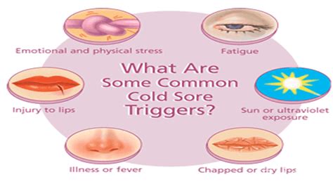 How To Treat Childrens Cold Sores