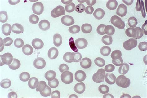 Free Picture Micrograph Blood Smear Microgametocyte Parasite
