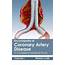 Encyclopedia Of Coronary Artery Disease Volume I A Complete Medical 