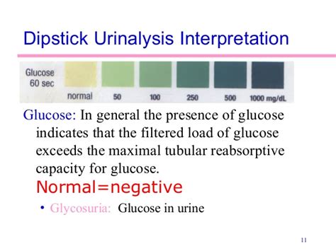 Diseases of the kidney and the urinary tract can present with a wide array of symptoms. Urinalysis