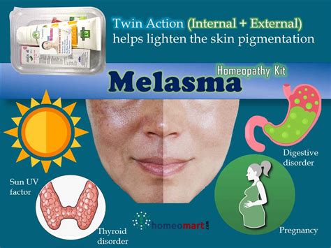 Best Treatment For Melasma On Face Drpranjali Melasma Kit