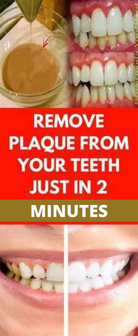 remove plaque from your teeth just in 2 minutes homemade mouthwash