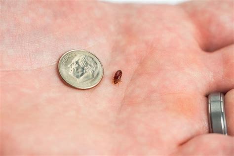 Pest Company Says Dc Now No 1 For Bedbugs Wtop News