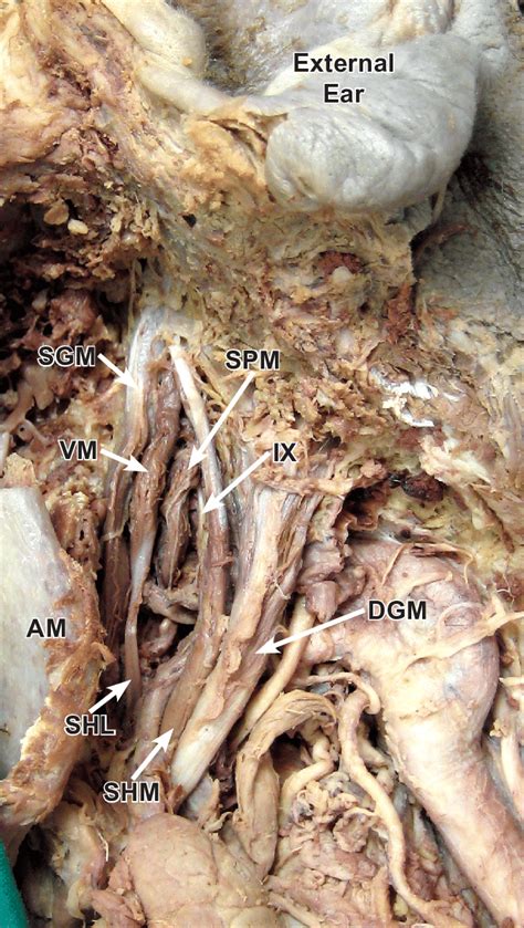Mylohyoid Muscle Cadaver
