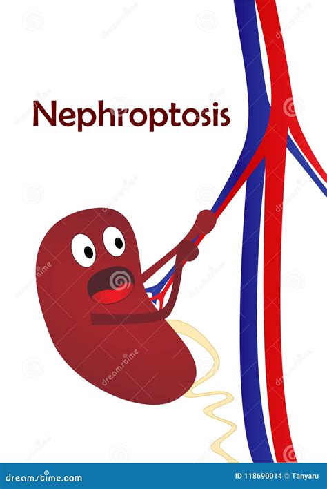Kidney Disease Nephroptosis One Cartoon Kidney Isolated On White
