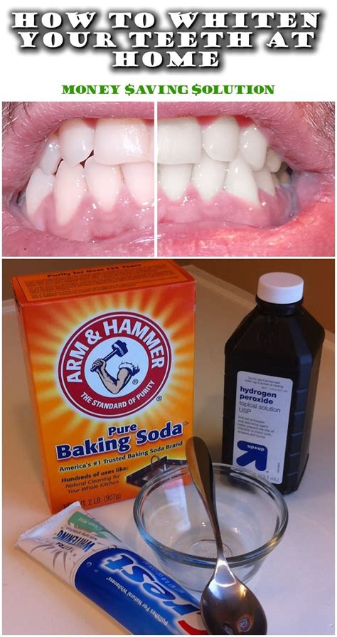 Both items are natural and mix together a teaspoon of baking soda with just enough hydrogen peroxide to form a paste. Pin on Your Best DIY Projects