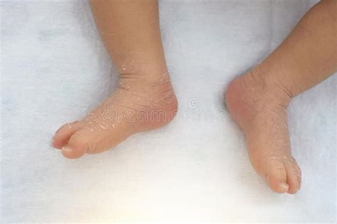 The Skin Of A Newborn S Feet On A White Cloth Stock Photo Image Of
