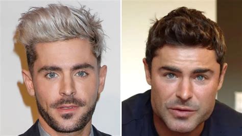 zac efron transformation actor revealed what really happened to his face