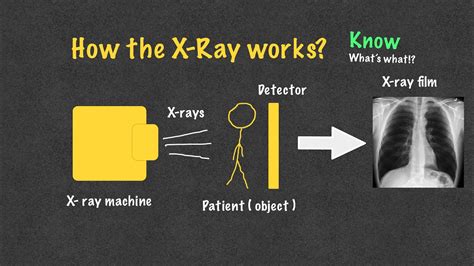 How The X Ray Works Basics With Examples Radiology Youtube