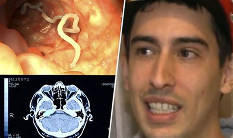Man Has Tapeworm Removed From Brain Oddyap Oddity News