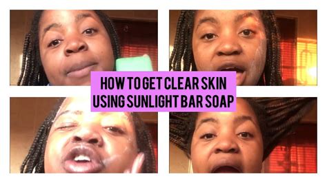 How To Get Clear Skin Using Sunlight Bar Soap 🧼 Skin Care Tips