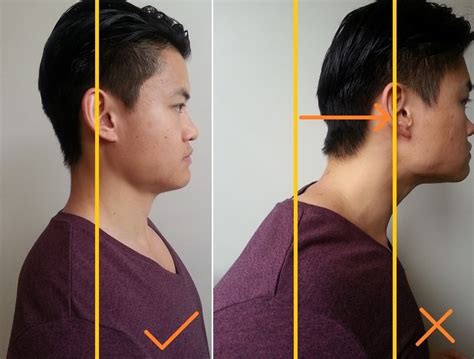 How To Fix Forward Head Posture Nerd Neck Posture Direct