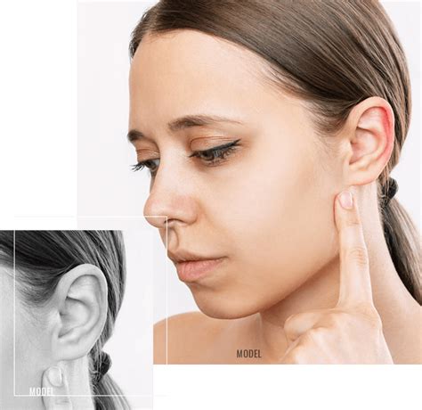 Earlobe Surgery Leyngold Institute For Plastic Surgery