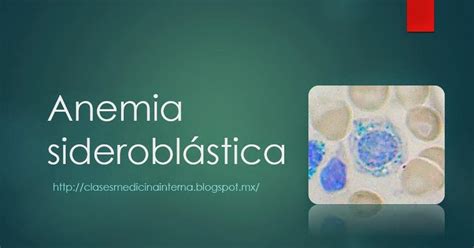 Clases De Medicina Anemia Sideroblástica