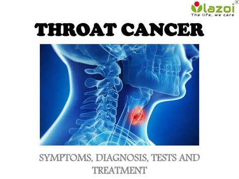 Ppt Throat Cancer Symptoms Diagnosis Tests And Treatment