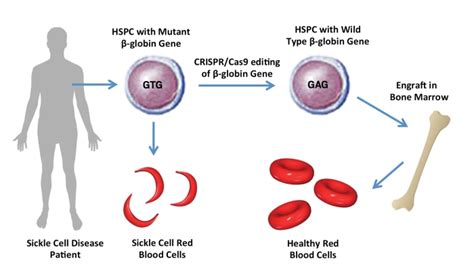 Crispr Edits Sickle Cell Mutation