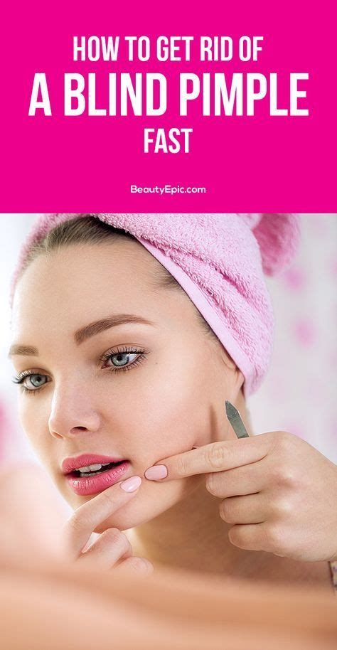 13 Easy Ways To Get Rid Of Blind Pimple Fast Blind Pimple Pimples