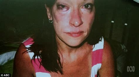 Woman Beaten By Her Husband Talks About Domestic Violence On Hitting