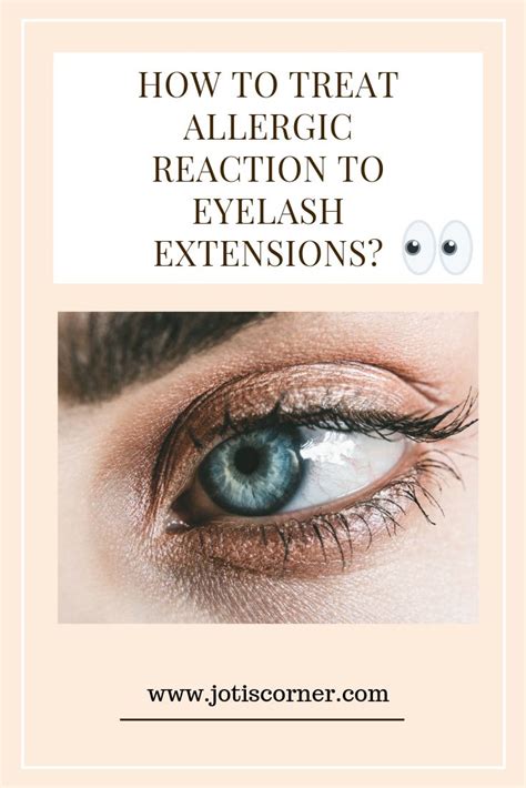 How To Treat Allergic Reaction To Lash Extensions Eyelash Extentions Eyelash Extensions