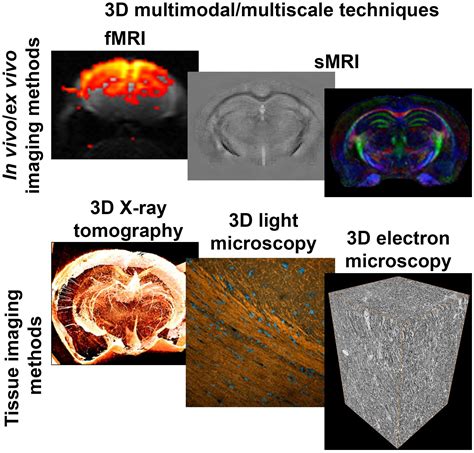 Frontiers Multiscale Imaging Approach For Studying The Central Nervous System Methodology And