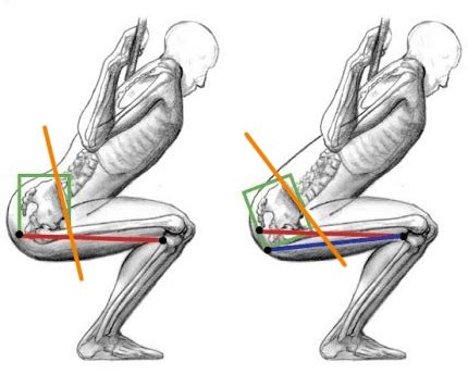Muscles located at the side of the hip, which include the gluteus medius, piriformis, and hip external rotator muscles contribute greatly to the well the best way to deal with low back pain that is either caused or complicated by tight outer hip muscles is to stretch the muscles mentioned above.﻿﻿ Fix Lower Back Pain Right Above Tailbone 4 Steps