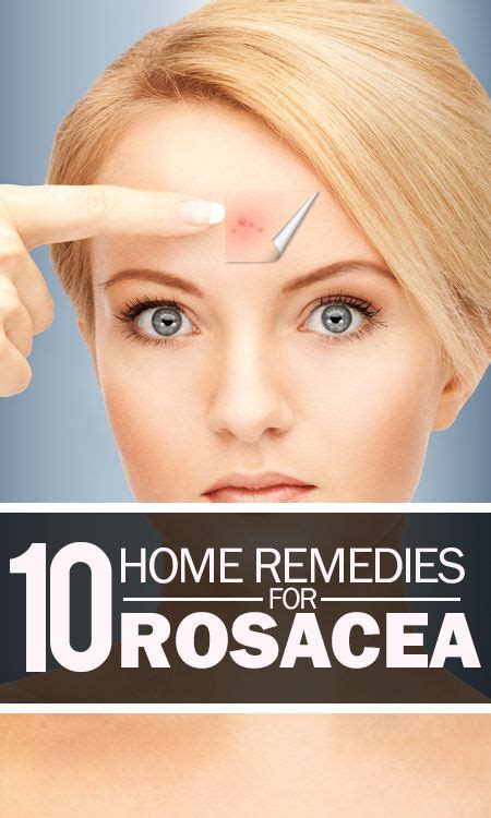 Rosacea wird durch vergrößerte blutgefäße verursacht, die auch sichtbar werden können. Die besten 25+ Rosacea pflege Ideen auf Pinterest | Akne ...