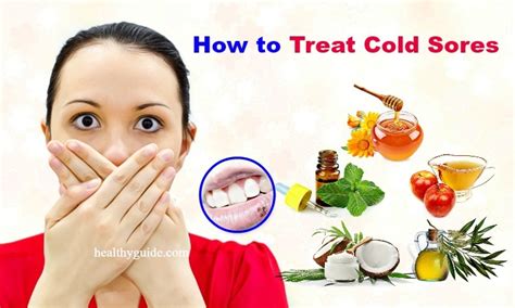 27 Tips How To Treat Cold Sores In Mouth Nose And On Lips Face Tongue