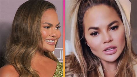 Chrissy Teigen Look Like Before And After Plastic Surgery The Hub