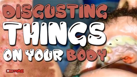 Disgusting Things On Your Body Youtube