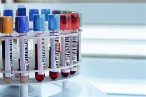 The complete blood count (cbc) includes several tests that evaluate red blood cells that carry oxygen, white blood cells that fight infections and platelets that help blood to clot. Quadra Medical : Packages