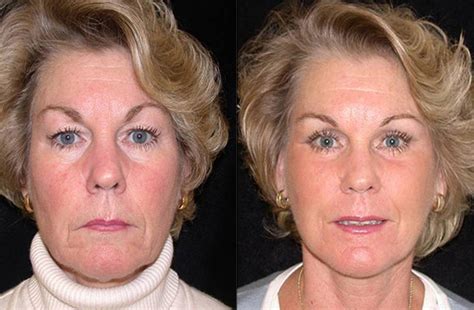 Shany eye and lip primer ensures that you have more control over application: Facelift Surgery Boston | Dr. Brooke Seckel