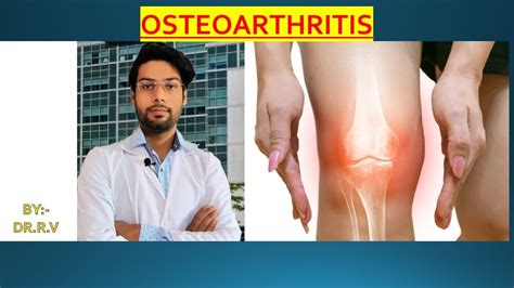 Osteoarthritis जोड़ों का दर्दगठिया Youtube
