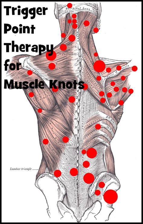 effective trigger point therapy for muscle knots remedygrove