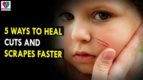 5 Ways To Heal Cuts And Scrapes Faster Health Sutra Best Health