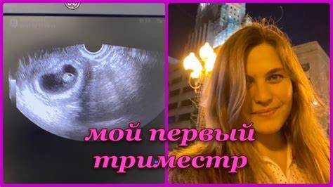 Диета при беременности 1 триместра