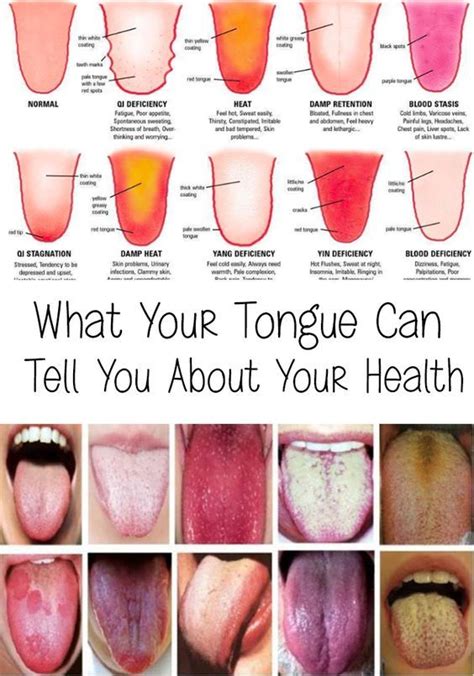 What Your Tongue Can Tell You About Your Health Tongue Health Healthy Tongue Health Tips