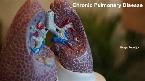 Chronic Obstructive Pulmonary Disease Medical English Practice YouTube