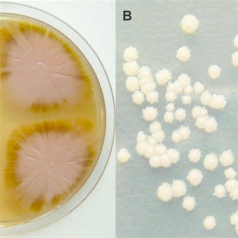 Aureobasidium Pullulans On Pda Medium After 14 Days Of Growth A