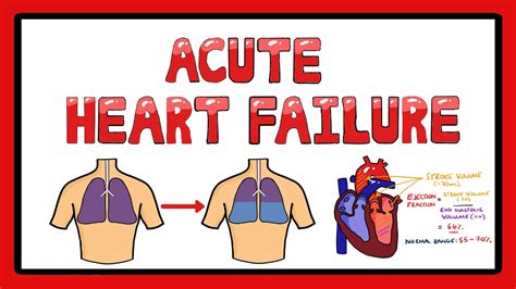 Acute Heart Failure Types Of Acute Heart Failure Causes Signs And