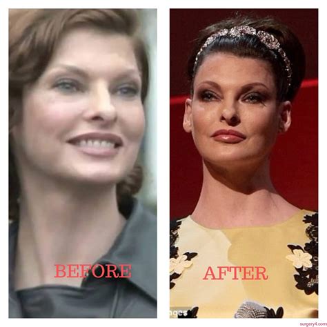 Linda Evangelista Plastic Surgery Photos Before And After ⋆ Surgery4