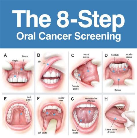 Oral Cancer Awareness Early Detection Is Key Oral And Maxillofacial