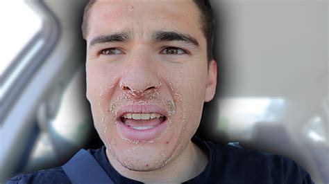 Something Is Really Wrong With My Face Youtube