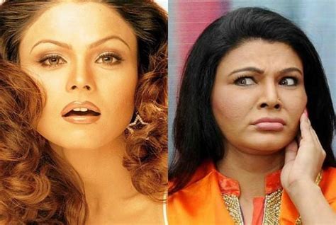 Image Of Before And After Plastic Surgery Of Bollywood Actress
