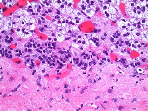 Pathology Outlines Anatomy And Histology Adrenal Cortex Medulla