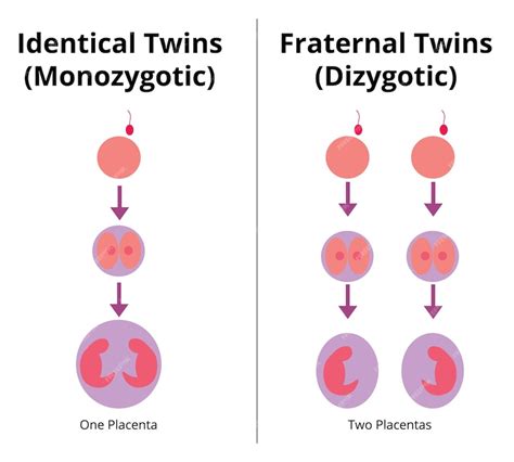 premium vector difference between identical and fraternal twins monozygotic and dizygotic twins